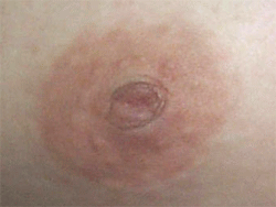 û_